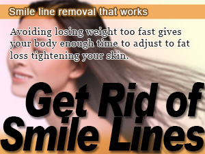 Smile line removal that works
