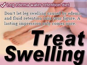 Leg edema water retention diet