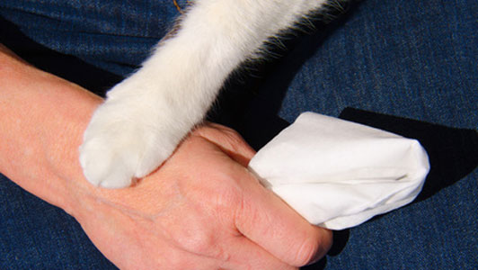 cat paw on hand of woman holding tissue