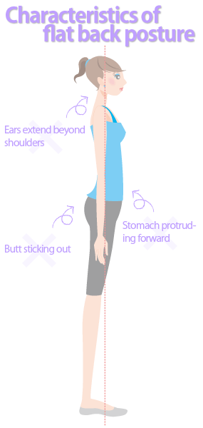 Characteristics of flat back posture