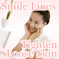 tighten Loose Skin Smile Line